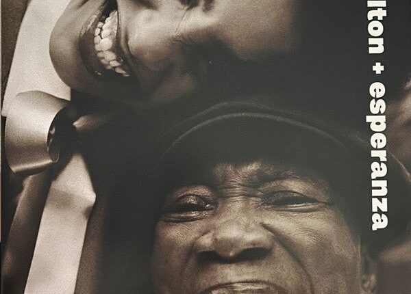 Milton Nascimento sofre de demência