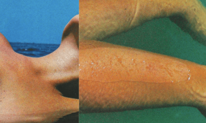 “Amor de Novo” junta NAPA a Jovem Dionisio